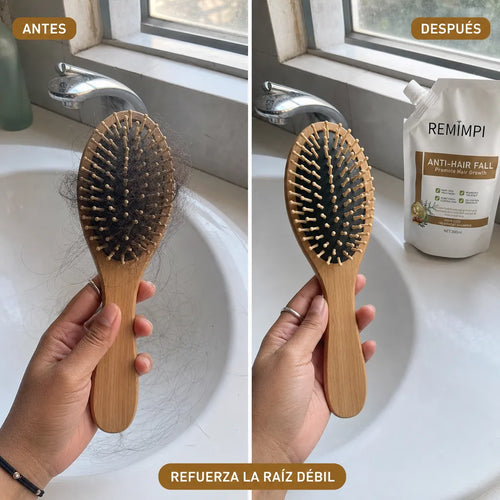 Upsell Shampoo Remimpi Anticaída Body Wise