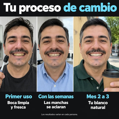 Blanqueador De Dientes Carbon